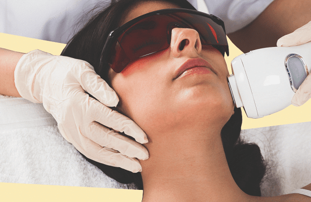 Різноманітність лазерів для епіляції : який обрати